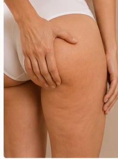 Mãos realizando massagem modeladora na coxa
